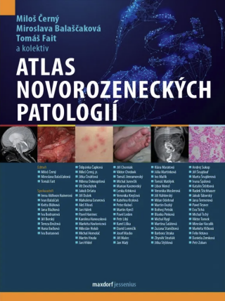 Atlas novorozeneckých patologií - Tomáš Fait,Miloš Černý,Miroslava Balaščaková