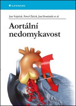 Aortální nedomykavost - Jan Vojáček,Pavel Žáček,Jan Dominik