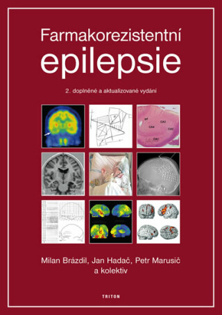 Farmakorezistentni epilepsie - 2. vydání - Jan Hadač,Milan Brázdil,Petr Marusič