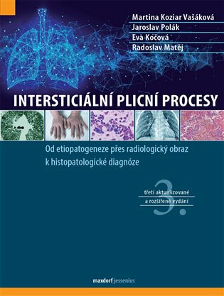 Intersticiální plicní procesy - Jaroslav Polák,Radoslav Matěj,Eva Kočová,Martina Koziar Vašáková