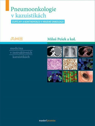 Pneumoonkologie v kazuistikách (Defekt) - Miloš Pešek