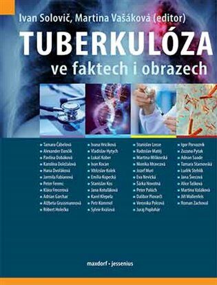 Tuberkulóza ve faktech i obrazech - Martina Vašáková,Solovič Ivan