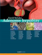 Adenomy hypofýzy - David Netuka