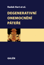 Degenerativní onemocnění páteře - Radek Hart,et al.