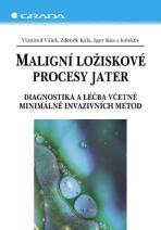 Maligní ložiskové procesy jater - Zdeněk Kala, Igor Kiss, ...