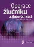 Operace žlučníku a žlučových cest - Jan Šváb