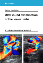 Ultrasound examination of the lower limbs - Dalibor Musil,et al.