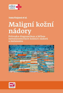 Maligní kožní nádory - Ivana Krajsová